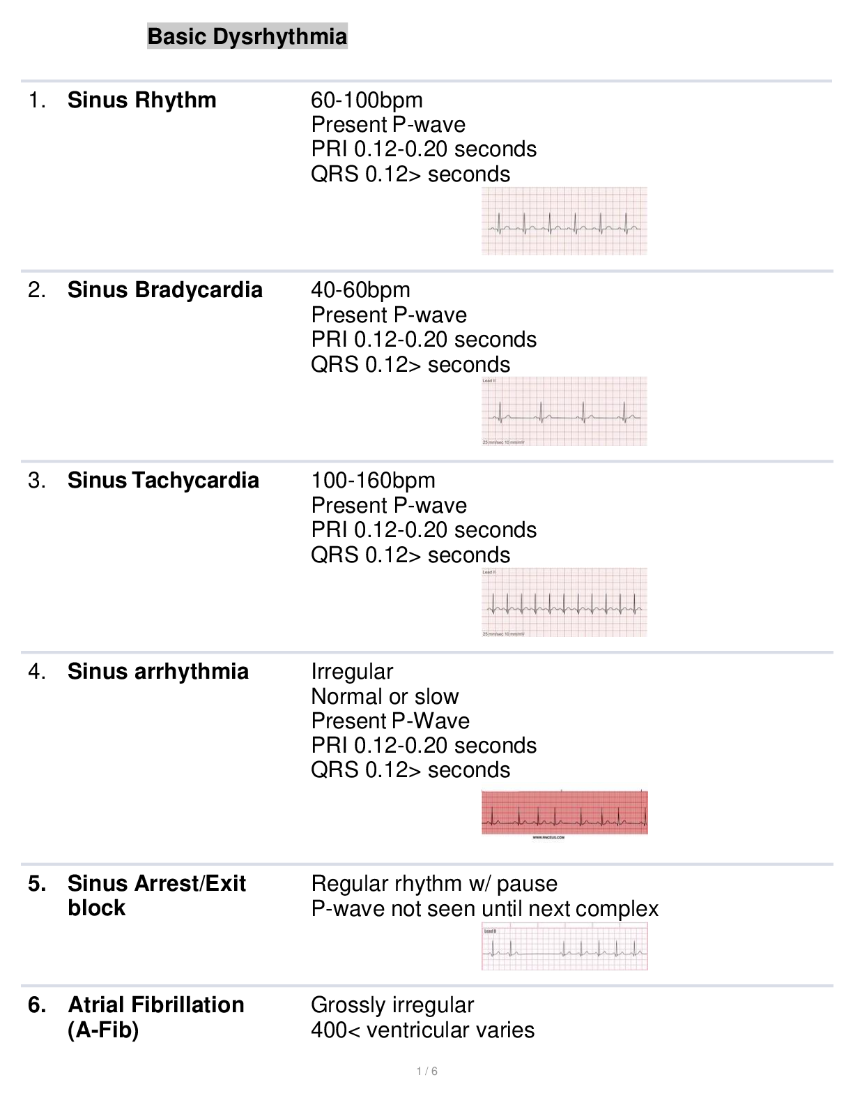 Preview image for Basic Dysrhythmia Latest Update